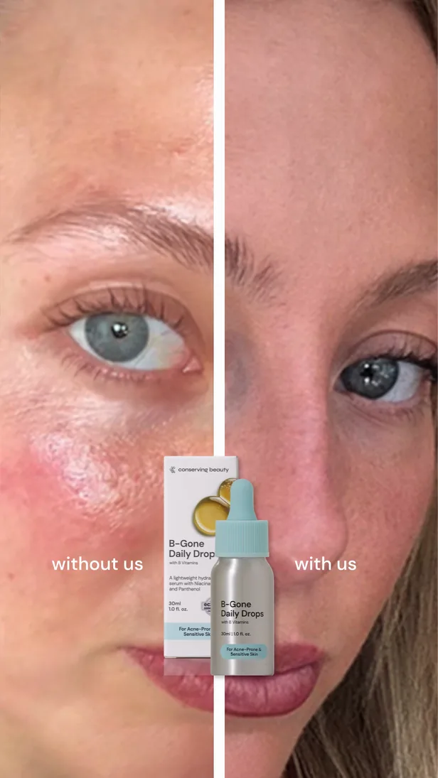 Conserving Beauty ad creative